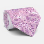 首のタイ-乳癌の細胞 ネクタイ (ロール)