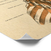 首の背骨の筋肉カイロプラクティックマッサージチャート ポスター (角)