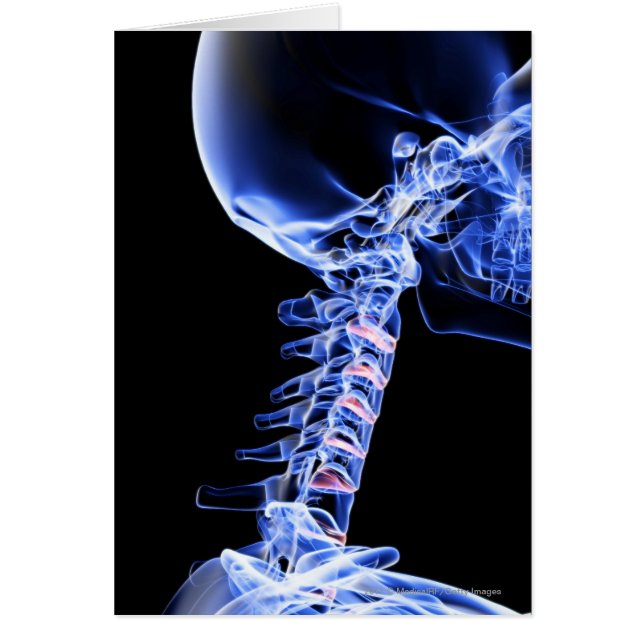 首の骨のイメージのX線撮影をして下さい (正面)