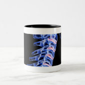 首の骨のイメージのX線撮影をして下さい ツートーンマグカップ (中央)