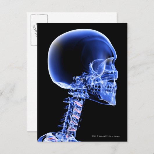 首の骨のクローズアップX線写真 ポストカード (正面/裏面)
