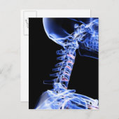 首の骨のX線画像 ポストカード (正面/裏面)