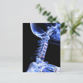 首の骨のX線画像 ポストカード (スタンド正面)