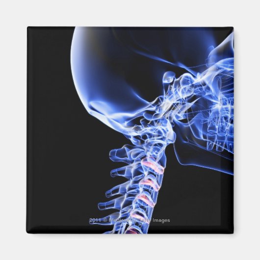 首の骨のX線画像 マグネット (正面)