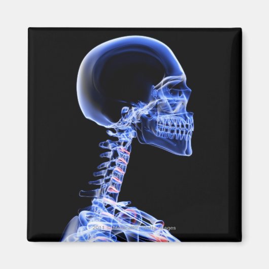 首の骨のX線 マグネット (正面)