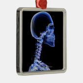 首の骨のX線 メタルオーナメント (右)