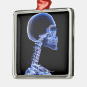首の骨のX線 メタルオーナメント (左)