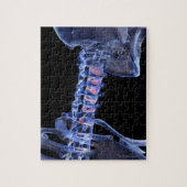 首の骨3 ジグソーパズル (縦)