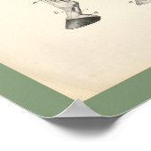 馬の獣医の脚の骨の筋肉解剖学プリント ポスター (角)