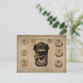 馬口の歯の年齢エッチング水色 ポストカード (スタンド正面)