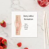 骨カルス形成 スタンダードカクテルナプキン (インサイチュ)