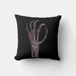 骨折ボーン手スケルトンX RAY Tシャツ クッション