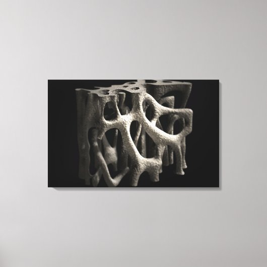 骨粗鬆症による骨構造 キャンバスプリント (正面)