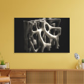 骨粗鬆症による骨構造 キャンバスプリント (インサイチュ (リビング))