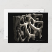 骨粗鬆症による骨構造 ポストカード (正面/裏面)