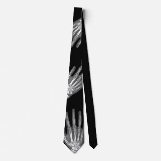 骨組手のX線メンズタイ ネクタイ (正面)
