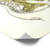 骨障害性交感神経鎖神経ポスター ポスター (角)