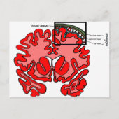 髄膜 ポストカード (正面)