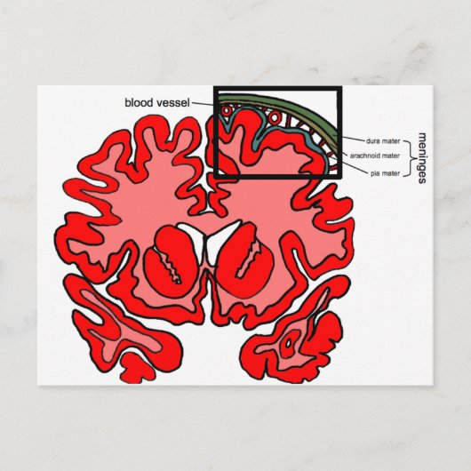 髄膜 ポストカード (正面)