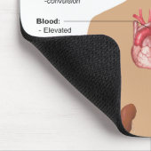 高血圧の図表の主要な複雑化 マウスパッド (コーナー)