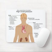 高血圧の図表の主要な複雑化 マウスパッド (マウス)