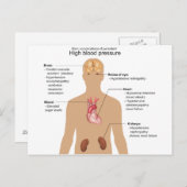 高血圧グラフの主な合併症 ポストカード (正面/裏面)