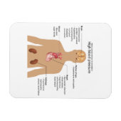 高血圧グラフの主な合併症 マグネット (横)