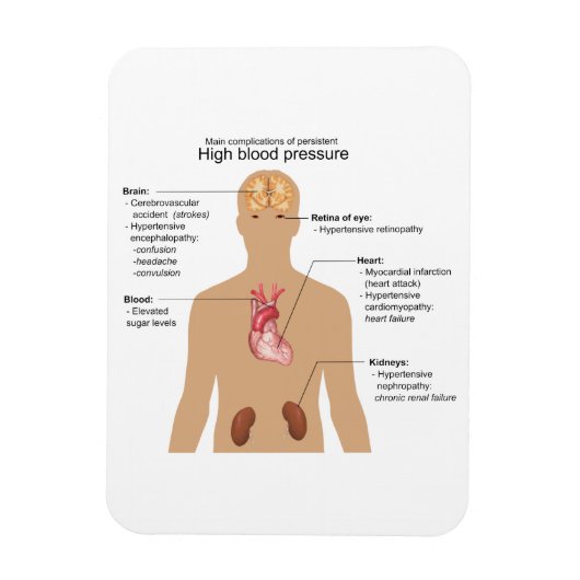 高血圧グラフの主な合併症 マグネット (縦)
