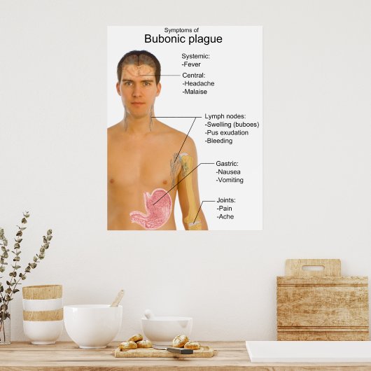 黒死腺ペスト表の主な症状 ポスター (キッチン)