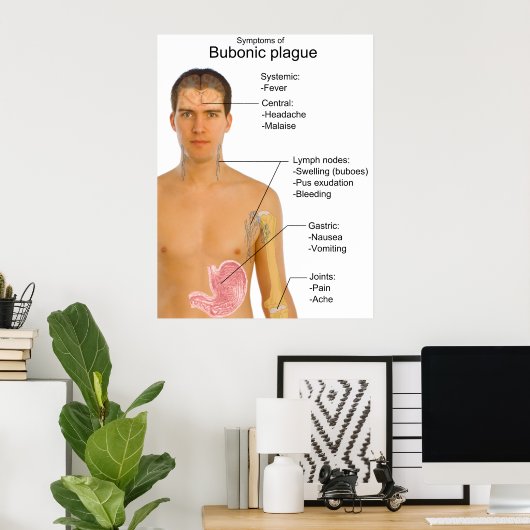 黒死腺ペスト表の主な症状 ポスター (ホームオフィス)