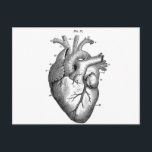 黒色解剖学的ハート ポストカード<br><div class="desc">解剖学生理学</div>