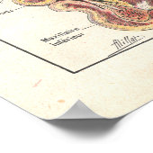 鼻とシナスの解剖学のポスターフランスの ポスター (角)