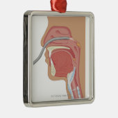 鼻の内視鏡検査法 メタルオーナメント (右)