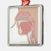 鼻の内視鏡検査法 メタルオーナメント (左)