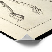 1691解剖学芸術的腕の骨アートプリント ポスター (角)