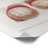 1833ヴィンテージ神経ヘッド顔解剖学ポスター ポスター (角)