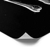 1844ヴィンテージ解剖学プリントティビア腓骨 ポスター (角)