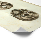 1844ヴィンテージ解剖学プリントヒトスカル ポスター (角)