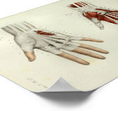 1844ヴィンテージ解剖学プリント筋肉手 ポスター (角)