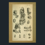 1850ヴィンテージプリント足足首 ポスター<br><div class="desc">ヴィンテージ1850解剖学的プリントイラストレーション.あなたのプリントの人間の足の骨とカスタマイズ足首.背景イメージを削除し、必要に応じて背景の色を変更できま縁どす。背景の色は必要に応じて変更できます。</div>
