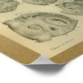 1850ヴィンテージ解剖学プリントヒトハート ポスター (角)