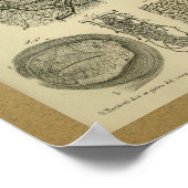 1850ヴィンテージ解剖学プリント眼動脈 ポスター (角)