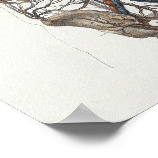 1867大動脈骨格ヴィンテージ解剖学プリント ポスター (角)