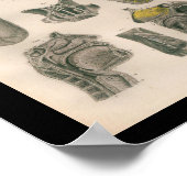 1879ヴィンテージブロック解剖学プリント鼻のど ポスター (角)