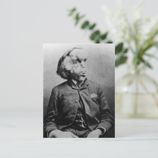 1889年のジョセフ「ジョン」メリック象の男 ポストカード (スタンド正面)