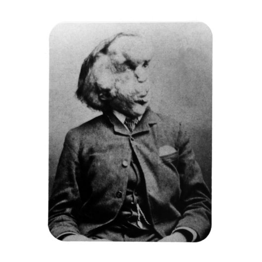 1889年のジョセフ「ジョン」メリック象の男 マグネット (縦)
