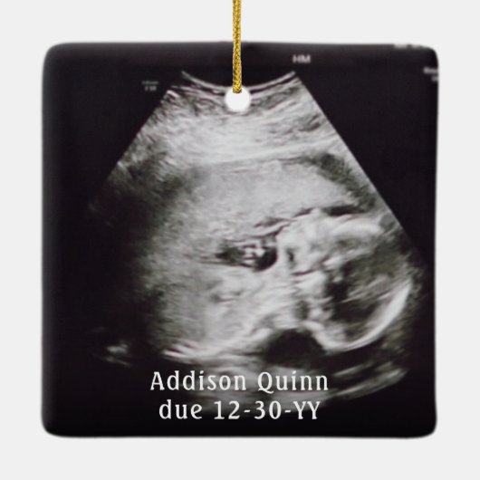 2写真妊娠の新しい親1番目のクリスマスが期待 セラミックオーナメント (裏面)