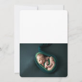 2枚のフォトベビーグリーンサンキューカード サンキューカード (裏面)