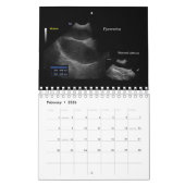 2024獣医超音波画像カレンダー カレンダー (2月 2026)