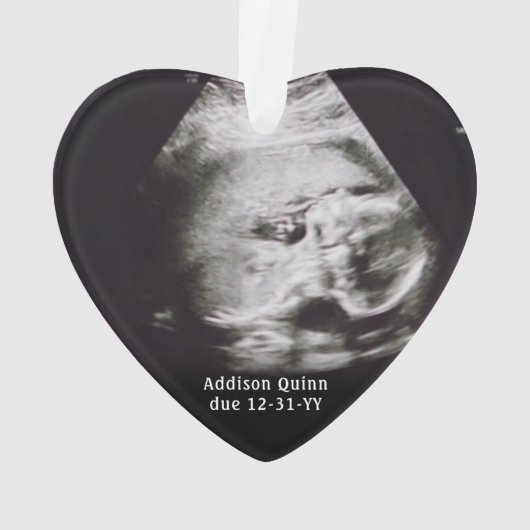 4写真妊娠1stクリスマスマーブルフェイクハート オーナメント (裏面)